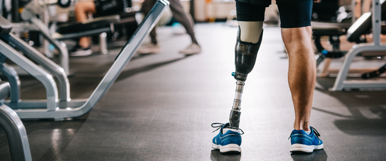 Behandlungsfehler Amputation